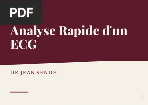 Analyse Rapide d'un ECG - Guide de Poche
