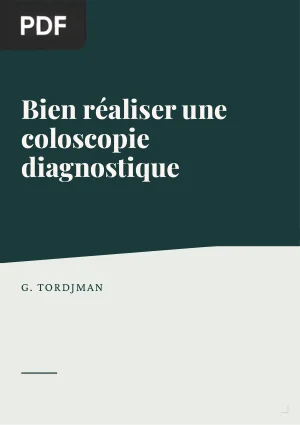 Bien réaliser une coloscopie diagnostique
