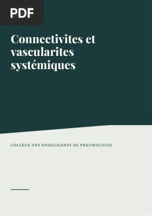 Connectivites et vascularites systémiques (Items 188 & 189)