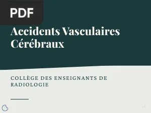 ECN : Accidents Vasculaires Cérébraux
