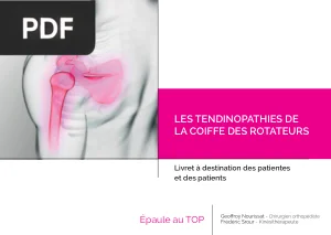 Les tendinopathies de la coiffe des rotateurs