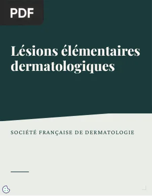 Lésions élémentaires dermatologiques